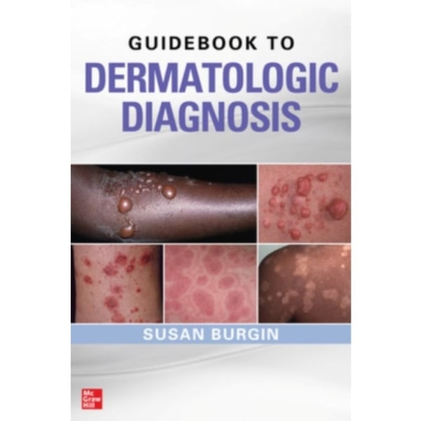 Guidebook to Dermatologic Diagnosis (häftad, eng)