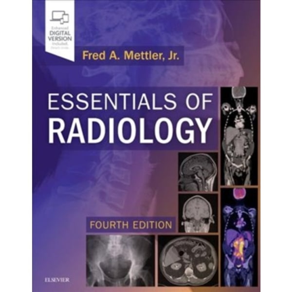 Essentials of Radiology (häftad, eng)