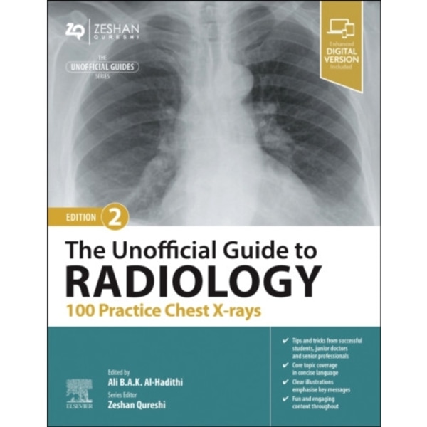 The Unofficial Guide to Radiology: 100 Practice Chest X-rays (häftad, eng)