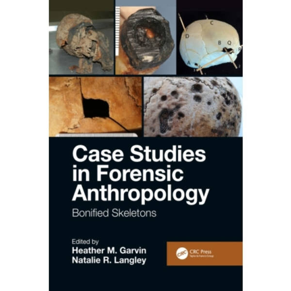 Case Studies in Forensic Anthropology (häftad, eng)