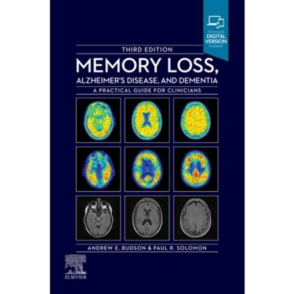 Memory Loss, Alzheimer's Disease and Dementia (häftad, eng)