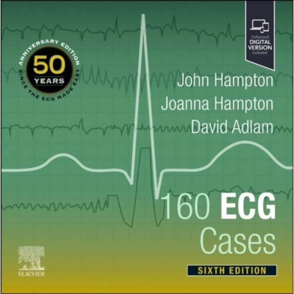 160 ECG Cases (häftad, eng)