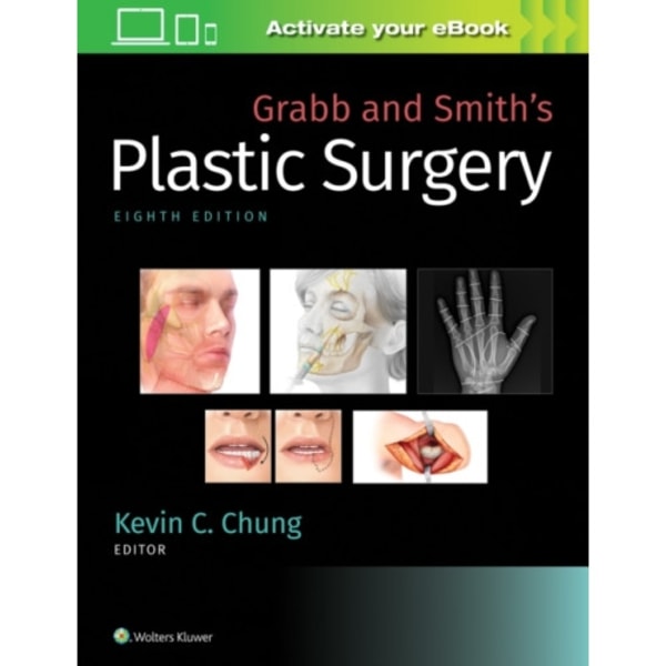 Grabb and Smith's Plastic Surgery (inbunden, eng)