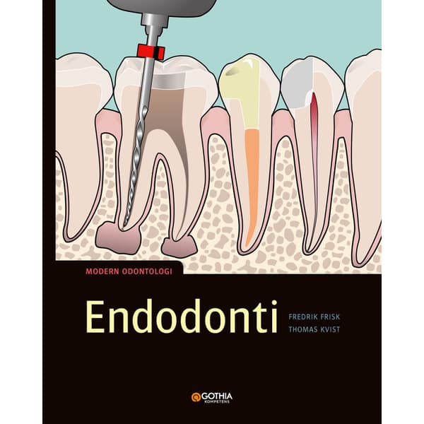 Endodonti (häftad)