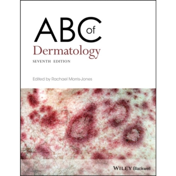 ABC of Dermatology (häftad, eng)