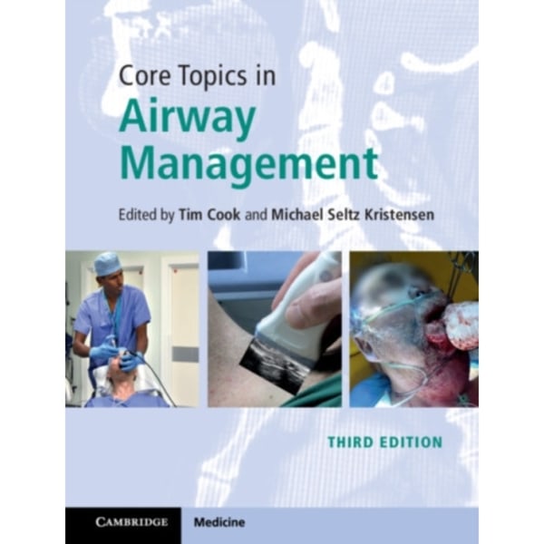 Core Topics in Airway Management (inbunden, eng)