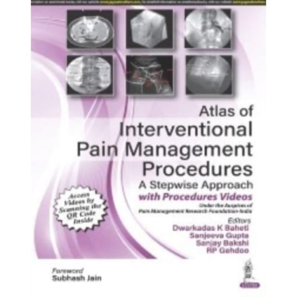 Atlas of Interventional Pain Management Procedures (inbunden, eng)