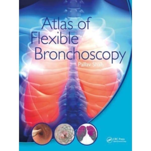 Atlas of Flexible Bronchoscopy (häftad, eng)