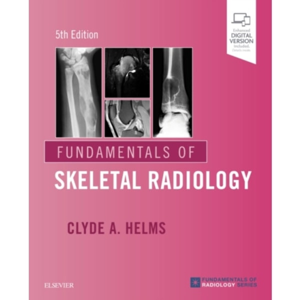 Fundamentals of Skeletal Radiology (häftad, eng)