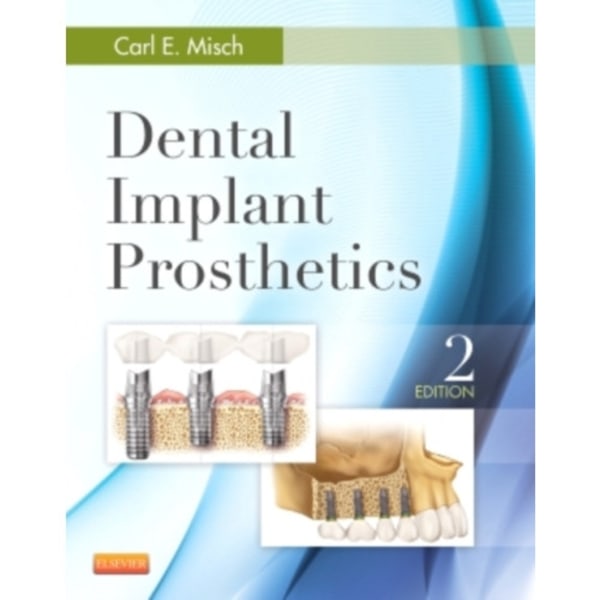 Dental Implant Prosthetics (inbunden, eng)