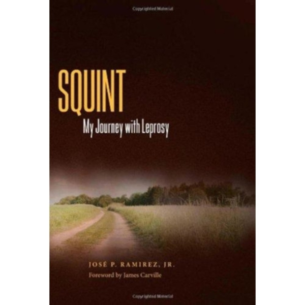 Squint (inbunden, eng)