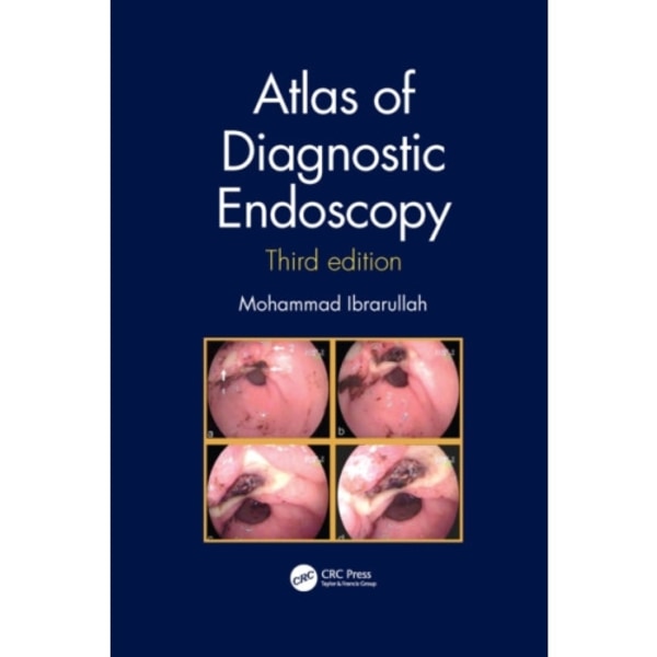 Atlas of Diagnostic Endoscopy, 3E (häftad, eng)