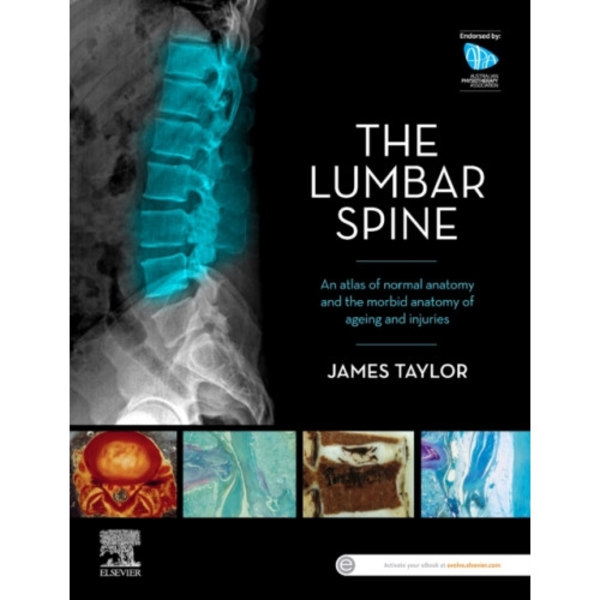 The Lumbar Spine (häftad, eng)