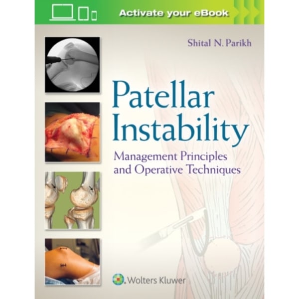 Patellar Instability (inbunden, eng)