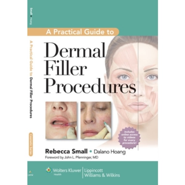 A Practical Guide to Dermal Filler Procedures (inbunden, eng)