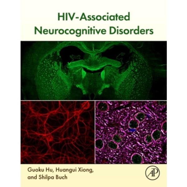 HIV-Associated Neurocognitive Disorders (häftad, eng)