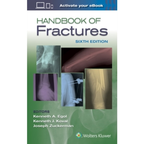 Handbook of Fractures (häftad, eng)