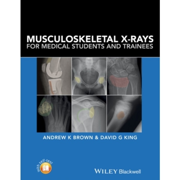 Musculoskeletal X-Rays for Medical Students and Trainees (häftad, eng)