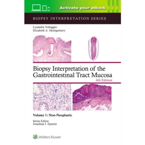 Biopsy Interpretation of the Gastrointestinal Tract Mucosa Volume 1 (inbunden, eng)
