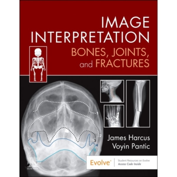 Image Interpretation: Bones, Joints, and Fractures (häftad, eng)
