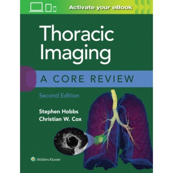 Thoracic Imaging: A Core Review (häftad, eng)