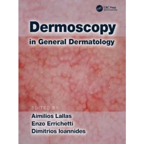 Dermoscopy in General Dermatology (inbunden, eng)