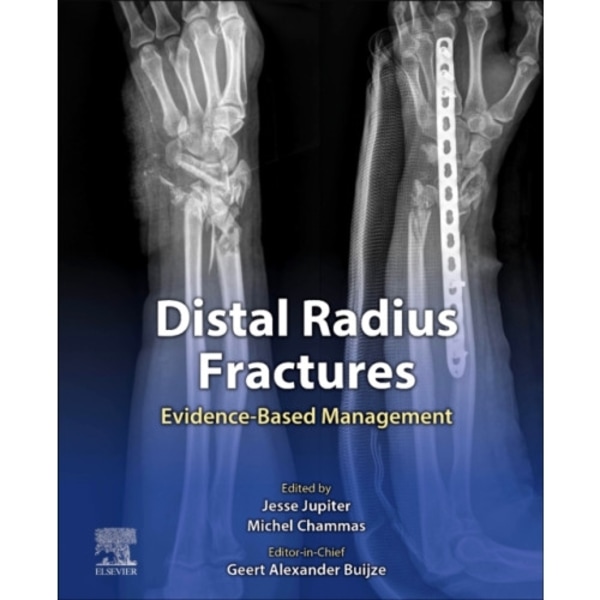 Distal Radius Fractures (inbunden, eng)