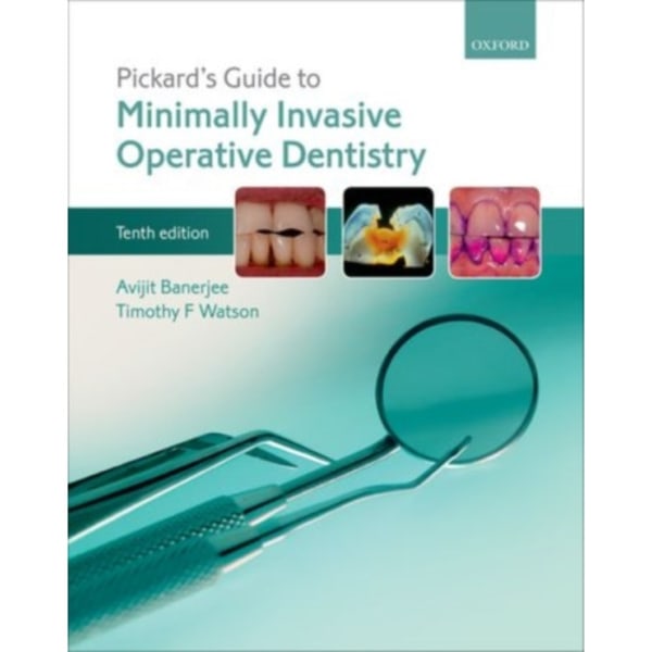 Pickard's Guide to Minimally Invasive Operative Dentistry (häftad, eng)