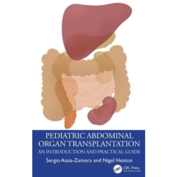 Pediatric Abdominal Organ Transplantation (häftad, eng)