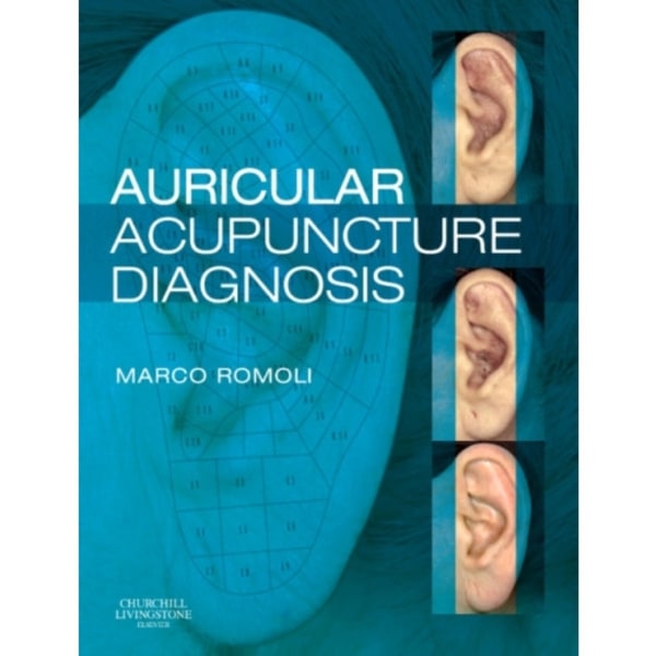 Auricular Acupuncture Diagnosis (inbunden, eng)