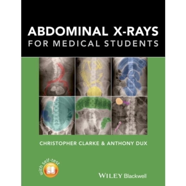 Abdominal X-rays for Medical Students (häftad, eng)