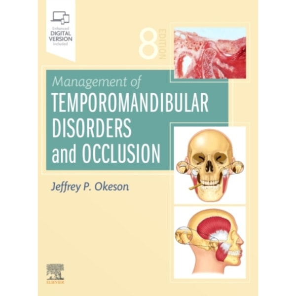 Management of Temporomandibular Disorders and Occlusion (inbunden, eng)