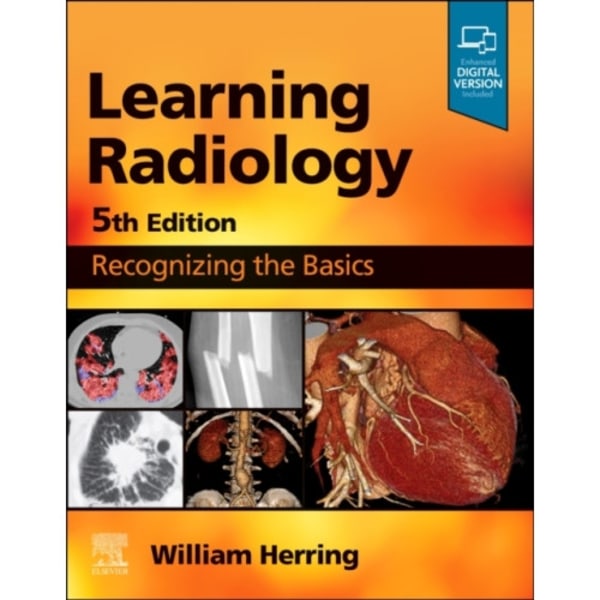 Learning Radiology (häftad, eng)