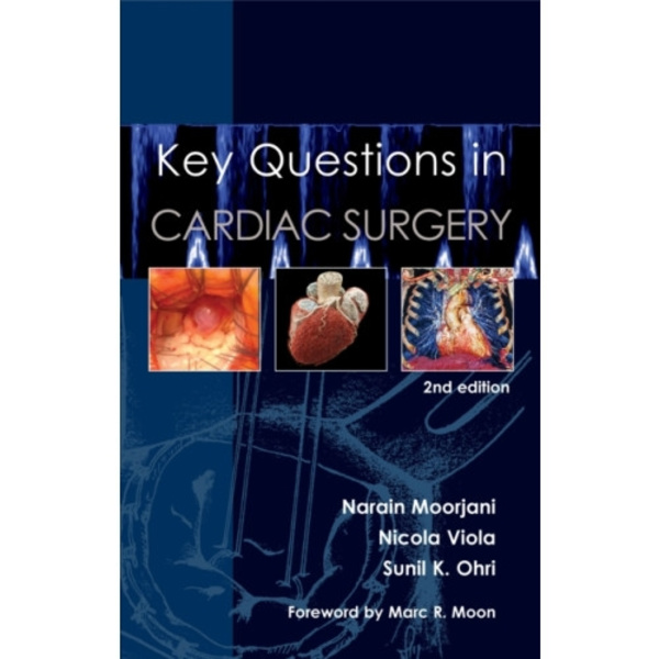Key Questions in Cardiac Surgery (häftad, eng)