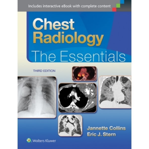 Chest Radiology: The Essentials (inbunden, eng)