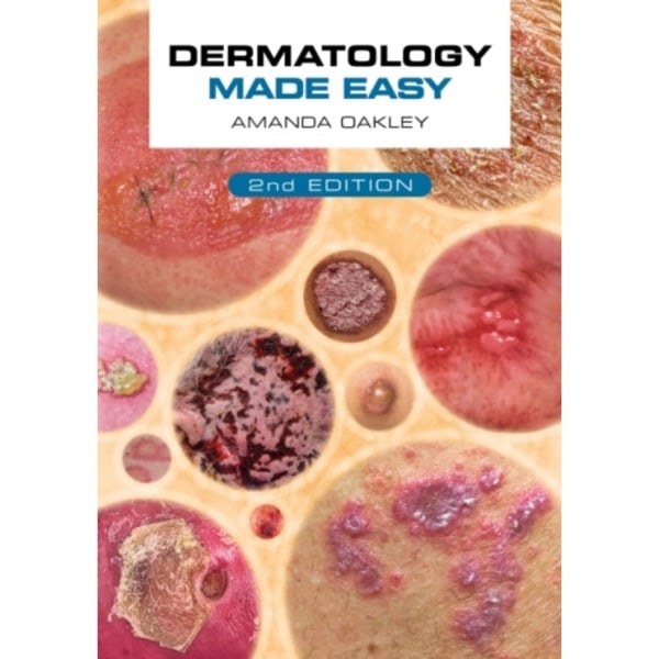 Dermatology Made Easy, second edition (häftad, eng)