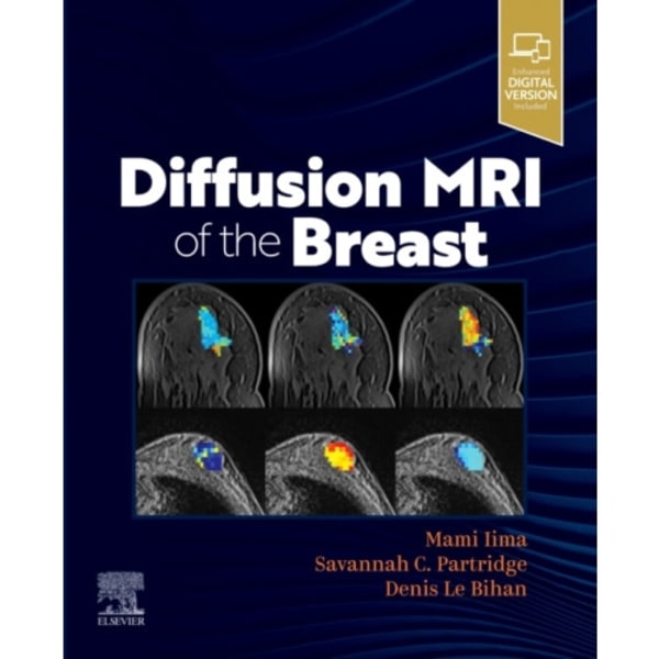 Diffusion MRI of the Breast (häftad, eng)