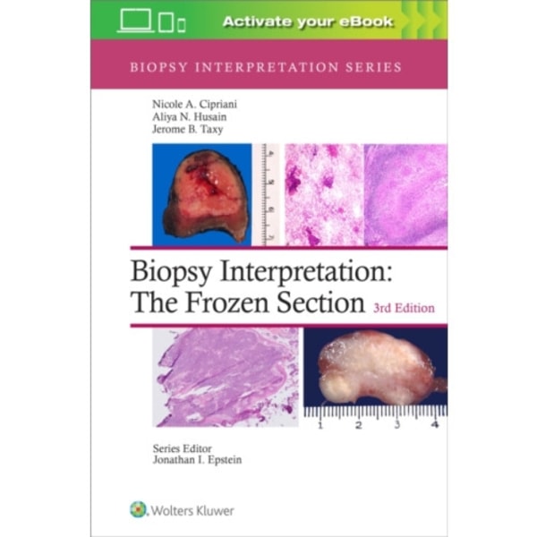 Biopsy Interpretation: The Frozen Section: Print + eBook with Multimedia (inbunden, eng)