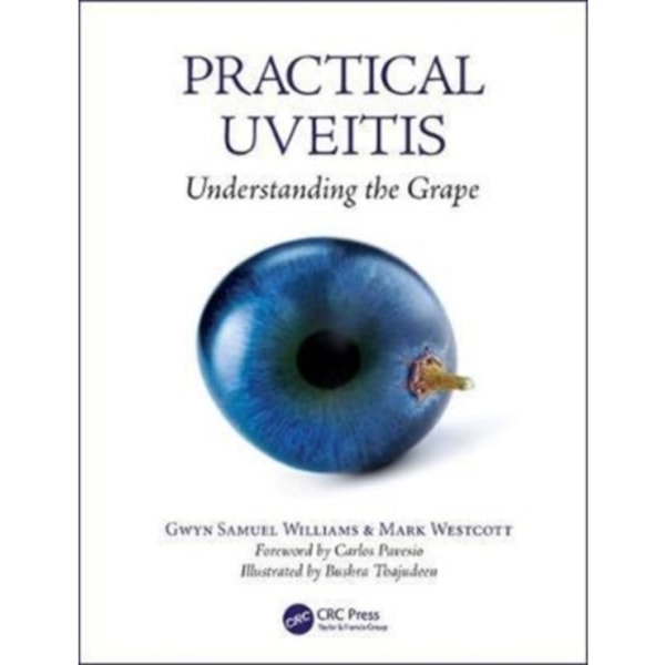 Practical Uveitis (häftad, eng)