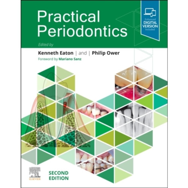 Practical Periodontics (häftad, eng)