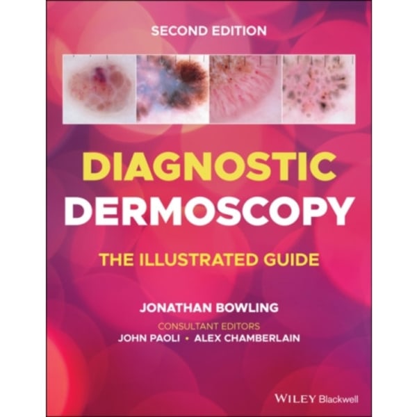 Diagnostic Dermoscopy (häftad, eng)