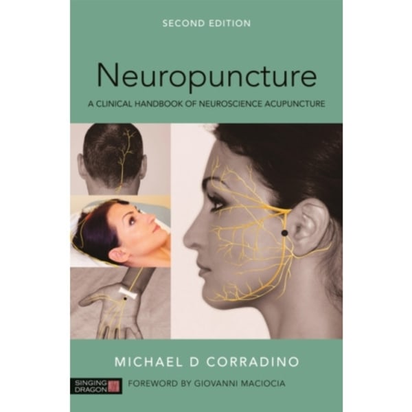 Neuropuncture (häftad, eng)