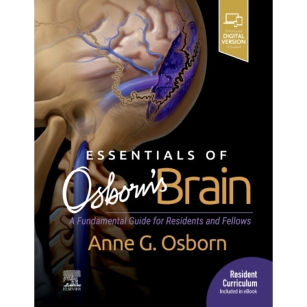 Essentials of Osborn's Brain (inbunden, eng)