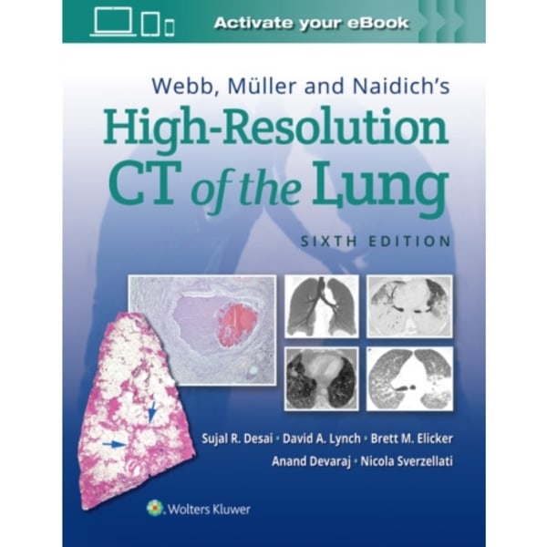 Webb, Muller and Naidich's High-Resolution CT of the Lung (inbunden, eng)