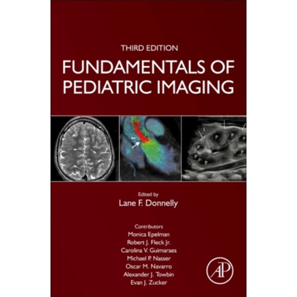 Fundamentals of Pediatric Imaging (inbunden, eng)