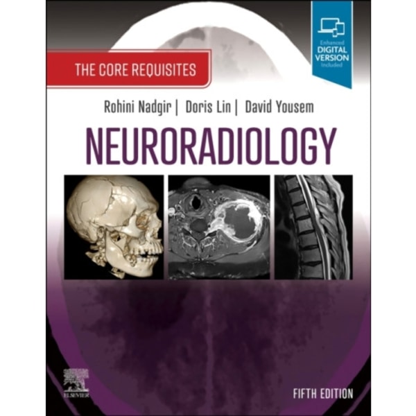 Neuroradiology (häftad, eng)