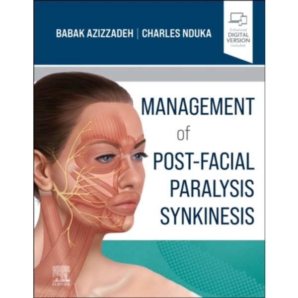 Management of Post-Facial Paralysis Synkinesis (inbunden, eng)