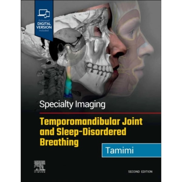 Specialty Imaging: Temporomandibular Joint and Sleep-Disordered Breathing (inbunden, eng)