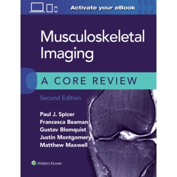 Musculoskeletal Imaging: A Core Review (häftad, eng)
