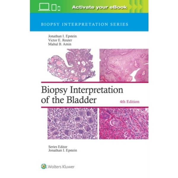 Biopsy Interpretation of the Bladder: Print + eBook with Multimedia (inbunden, eng)